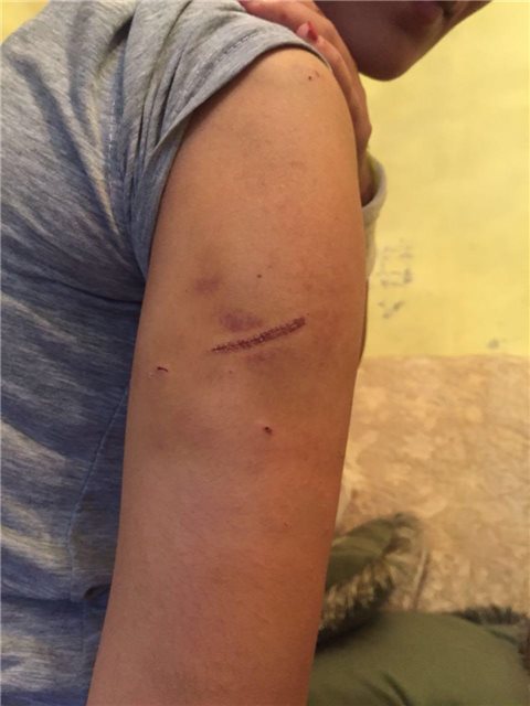 Saçı qırxılan qadına verilən işgəncə izlərinin   ŞOK görüntüləri yayıldı (Fotolar, +18)